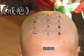 为什么和尚头上要点“戒疤”，戒疤又代表什么呢