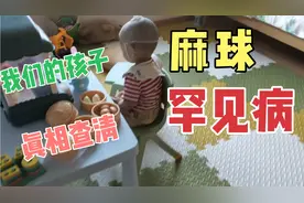 麻球得了罕见病 全部查清 今天公布 朗格罕 希望平安  家人都心疼
