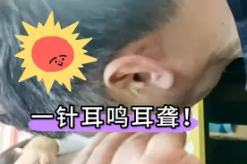 蒙古绝技：耳鸣耳聋，一针听宫穴！视频封面