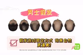 男士假发科普视频#脱发情况和假发固定方式的秘密你知道吗？