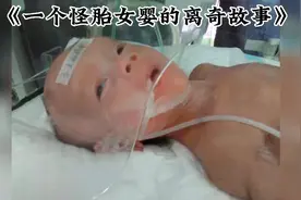 怪胎女婴出生就失去了妈妈，还有一口气医院却放弃了她......视频封面