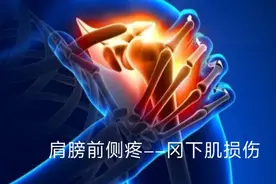 肩膀前侧疼的原因系列之冈下肌损伤，一个需要重视的点