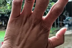 类风湿关节炎患者#熬川乌过程，刚熬好10.30