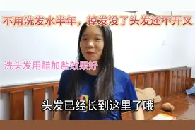 用姜盐醋养发半年只要水里加一款草本植物，头发乌黑不掉发效果好