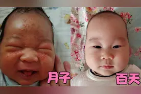 刚出生奇丑无比的宝宝，月子里脸上长满痤疮，还好当初没把他扔了视频封面