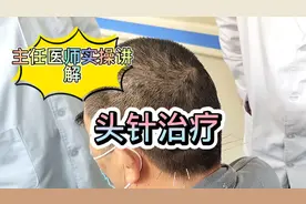 病案精讲:脑干梗死后遗症，造成头晕，头针治疗，针灸实操讲解!视频封面