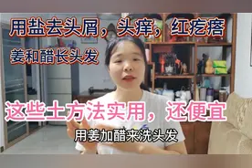 免费告诉你养发小妙招，用盐醋姜轻松搞定头屑掉发再生发，太便宜