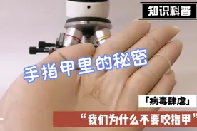 马上闭上你的嘴吧！一克的指甲里面有35亿个细菌你还咬指甲装嫩吗视频封面