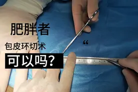 肥胖患者适合做包皮环切手术吗