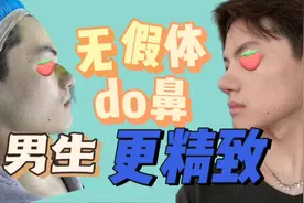 男生do鼻案例 无假体隆鼻 男生也可以更精致视频封面