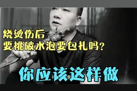 烧烫伤后要挑破水泡要包扎吗？你应该这样做！视频封面