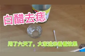 生活小妙招，宝妈用白醋去痣，用了六天，效果不错，大家一起交流视频封面