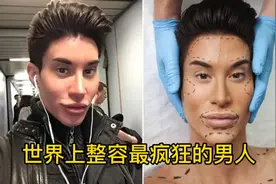 世界上整容最疯狂的男人，既然还在后背植入翅膀。视频封面