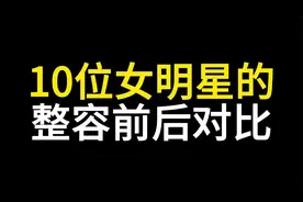 10位女明星整容前后对比，堪比换头，有几个整容失败，太可惜了视频封面