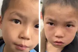 广西熊孩子抓蛇到学校被训哭，他的经历令人吃惊😱视频封面