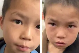 广西熊孩子抓蛇到学校被训哭，他的经历令人吃惊😱视频封面