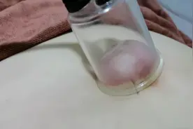 气血足不足自己拔个罐就能知道，你的身体可以自己检查一下视频封面