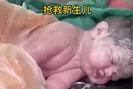 刚出生的宝宝因为宫内缺氧没有呼吸,医生奋力抢救视频封面