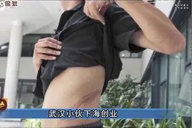 湖北省武汉市，20岁小伙一个腰子卖3万# 大案纪实..