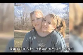 共享”身体的著名“双头姐妹”之一已婚，丈夫带着8岁女儿加入视频封面