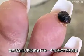 💅💅若不是央视揭秘，爱做美甲的女生还不知道，原来风险这么大！视频封面