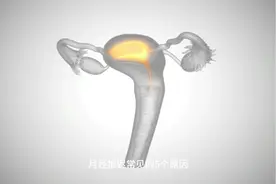 月经推迟的常见5个原因