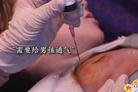 断肢小孩后续来了！英雄都是平凡人，但他们在关键时刻挺身而出视频封面