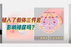 假体三件套影响排尿吗？揭秘泌尿系统奥秘！视频封面