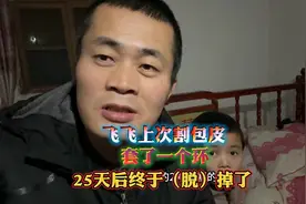 割包皮这个环，25天之后终于脱掉了