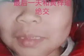 今天来整治星野