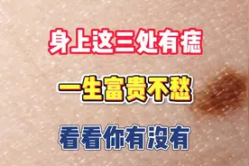身上这三处有痣，一生富贵不愁！看看你有没有 🌹 🌟 ✨视频封面