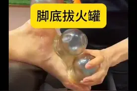 脚底拔火罐，轻松去湿气！