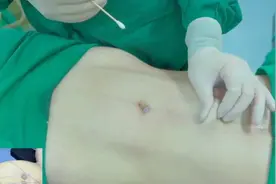 👉25岁女孩为追求完美身材丧失生育能力。视频封面