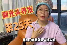 剃光头养发第25天，脂溢性脱发无需吃药，学会控油，就能止脱生发