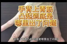 手背上青筋凸起到底是哪里出了问题