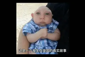 国外刚出生的宝宝无脑，医生建议安乐死宝妈执意留下，奇迹出现了视频封面