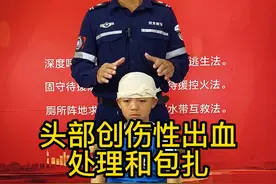 头部创伤性出血怎样处理和包扎。#急救 #消防安全 #急救技能 #涨知识@抖音短视频 