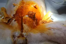 老年犬常见的乳腺肿瘤#宠物医生的日常 #手术室日常视频封面