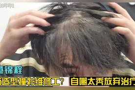 童啊 实在不行，把植发提上日程吧？#童锦程 #江南第一深情视频封面
