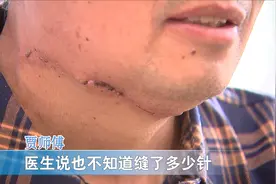 电瓶车加装前档玻璃隐患大 驾驶员被割喉险些丧命  #电瓶车视频封面