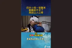 大家看看这个小孩看手机看的眼睛没有了
