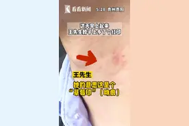 脖子上出现“吻痕”？女友气得要分手！男子：冤枉啊，睡出来的…#贵阳