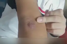 湖南岳阳：20岁青年进特训学校 一个月被打到肾衰竭