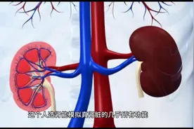 人造肾终于要出来了