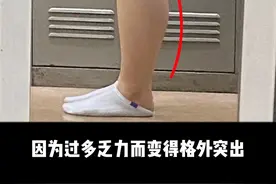膝关节超伸，会加剧腿型的不正，影响关节的稳定，大腿小腿也会代偿变粗。给大家分享一个动作改善，get细长直美腿！#纠正腿型 #直腿视频封面