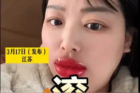 纹唇后仿佛点了老公的“笑穴”，女子:他笑了我一天一夜 #纹唇后的真实对比图 #纹唇多久可以消肿