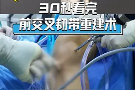 30秒看完前交叉韧带重建术#前交叉韧带重建 #前交叉韧带重建康复训练 #膝关节疼痛 #运动医学 #骨科视频封面