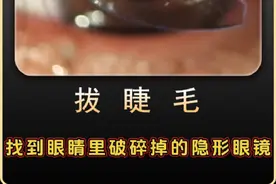 眼睛里破碎的隐形眼镜碎片！#解压 #戴隐形眼镜流泪怎么办