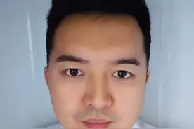 脑出血的位置和出血量，决定着是否手术和病人的预后！ #医学科普 #健康科普为人民 #脑出血 #关于喝酒这件事 #喝酒莫贪杯