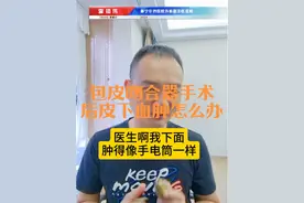 包皮吻合器手术后出现血肿怎么办 #包皮过长#包皮吻合器手术#包茎